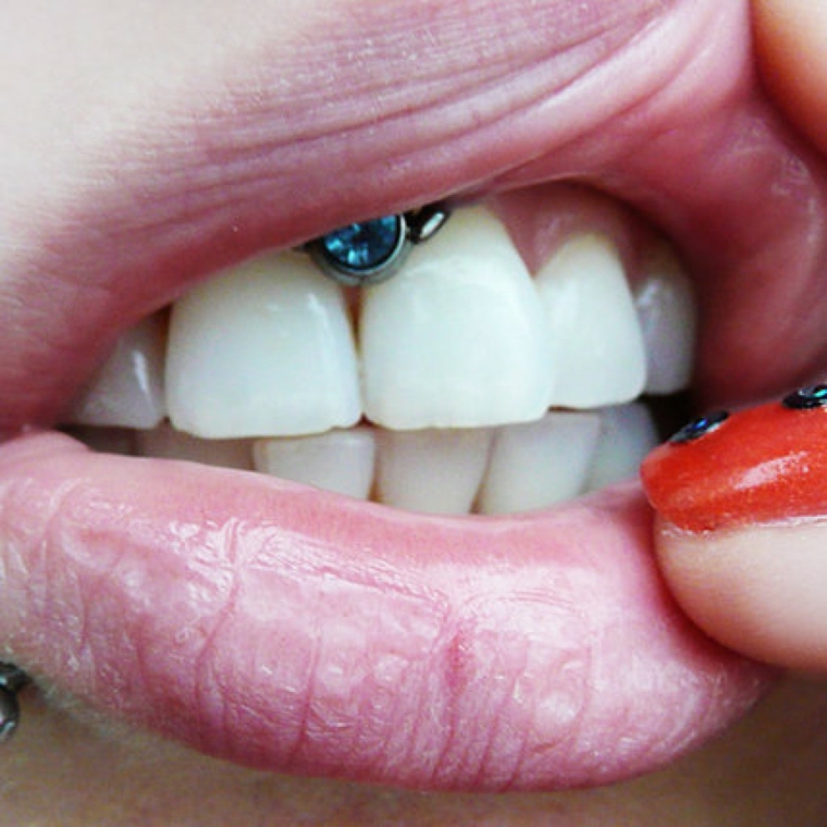 denti bianchi sotto le labbra piercing in bocca orecchino con brillantino blu