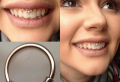 Smiley piercing: la bellezza di piercing nascosto, tutto quello che devi sapere!