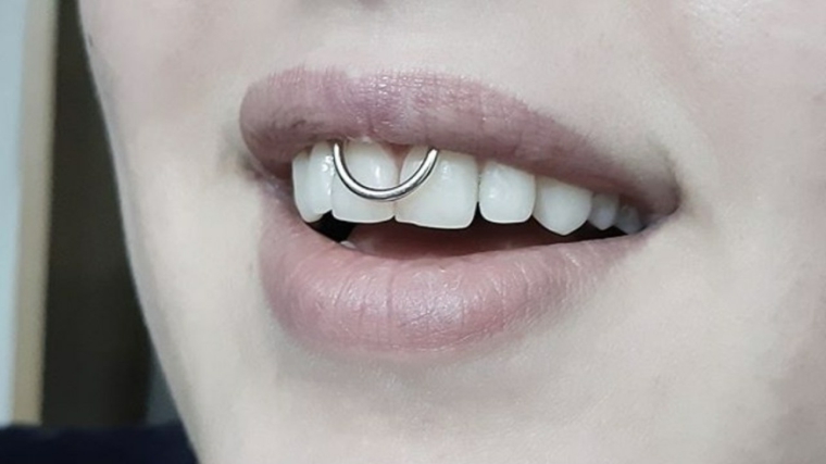 piercing all interno del labbro superiore in bocca ragazza con denti bianchi