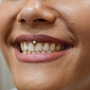 Smiley piercing: la bellezza di piercing nascosto, tutto quello che devi sapere!