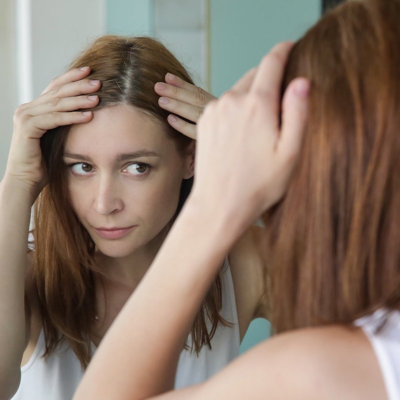 rimedi naturali contro la forfora capelli tinti