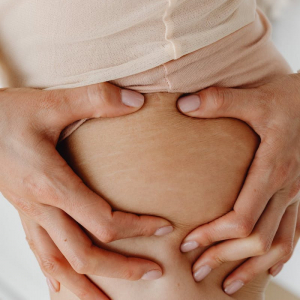 Come togliere le smagliature con i rimedi casalinghi