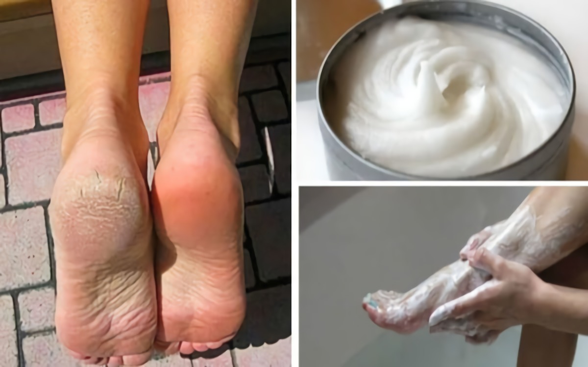 scrub piedi donna rimuovere la pelle morta con crema