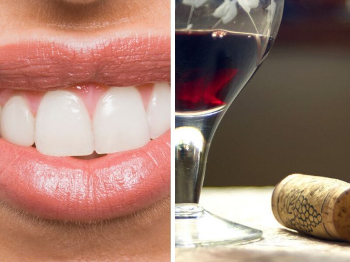macchie di vino sui denti consigli